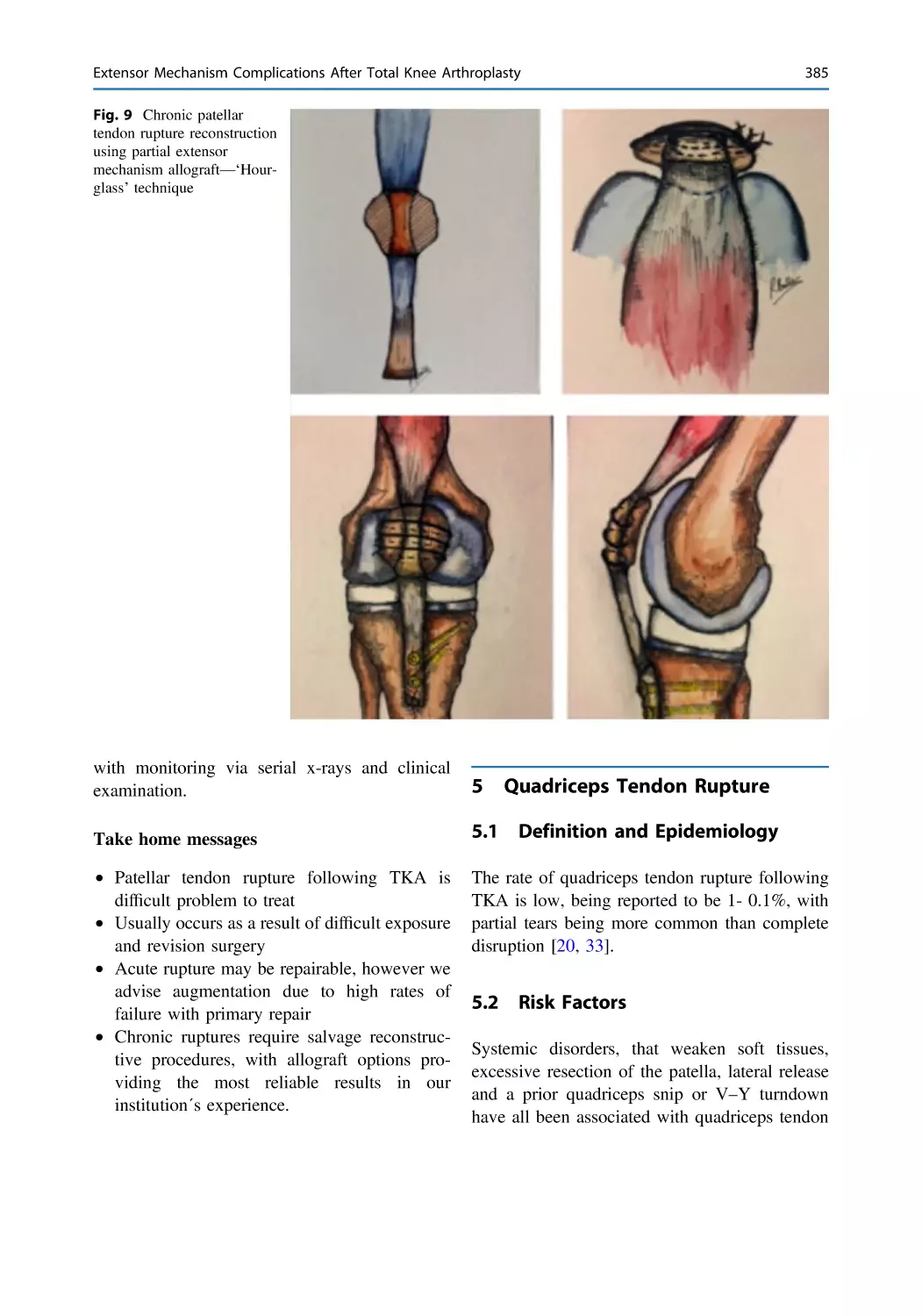 5 Quadriceps Tendon Rupture
5.1 Definition and Epidemiology
5.2 Risk Factors