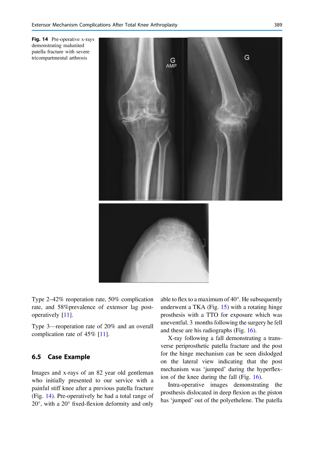 6.5 Case Example