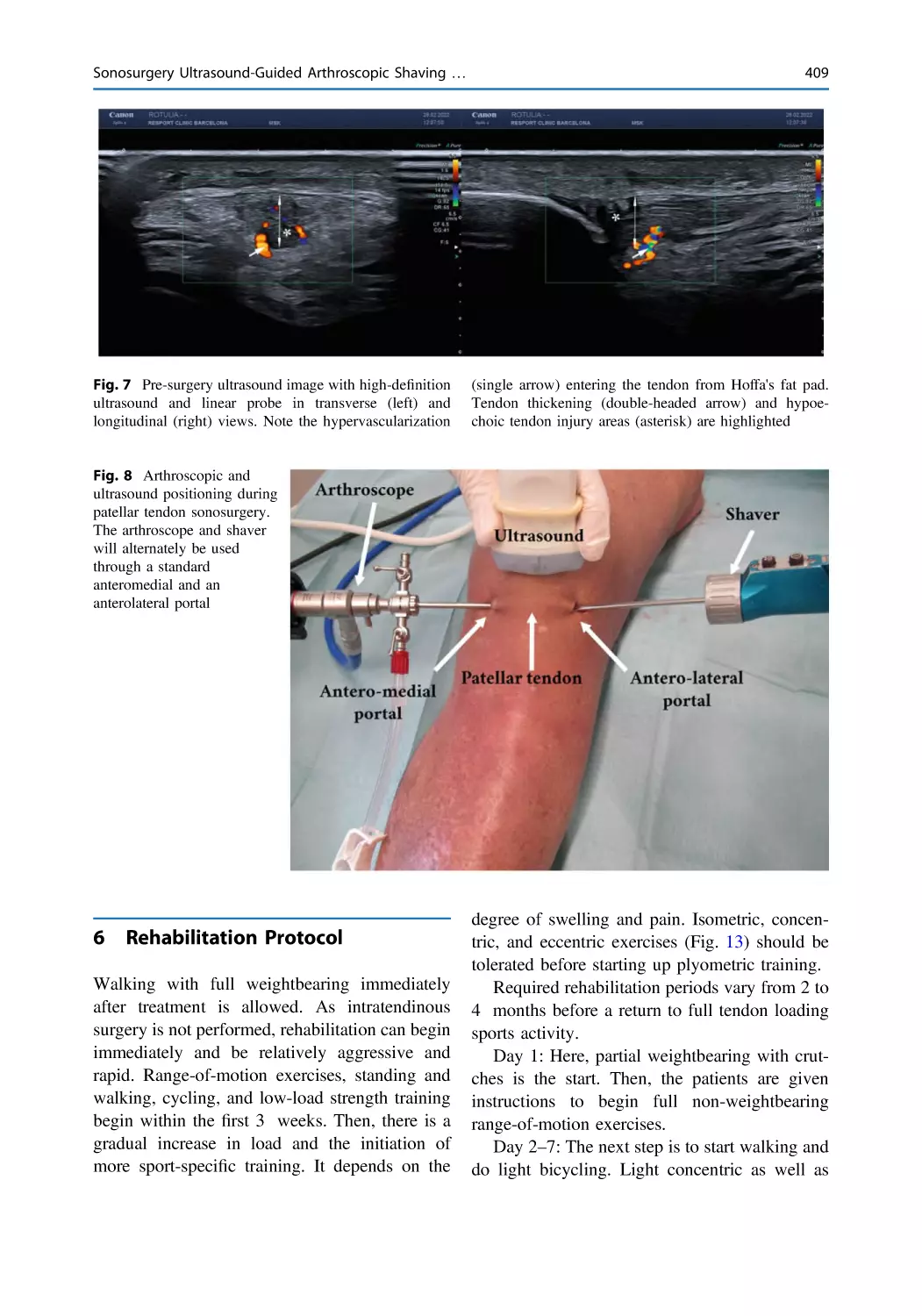 6 Rehabilitation Protocol