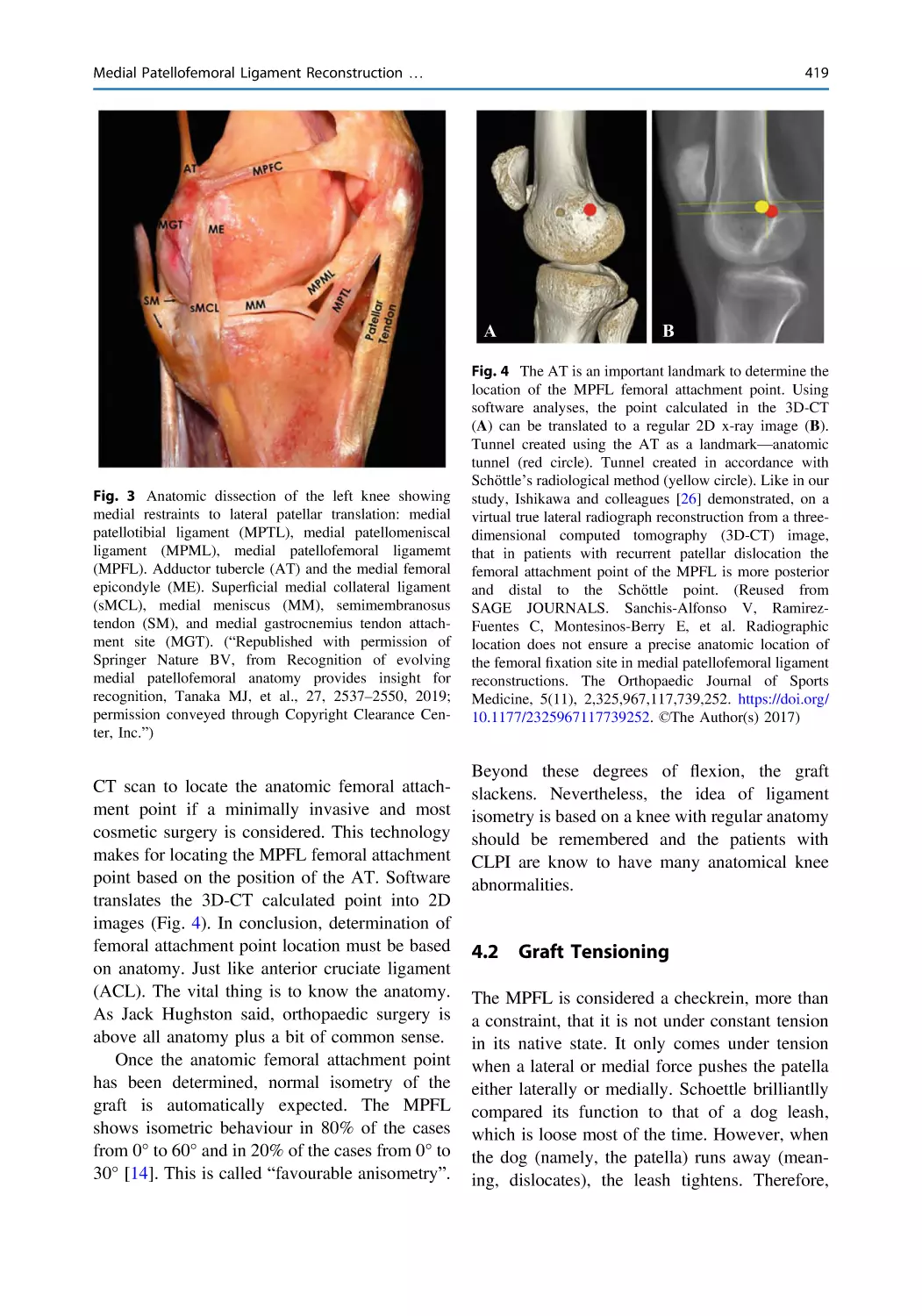 4.2 Graft Tensioning