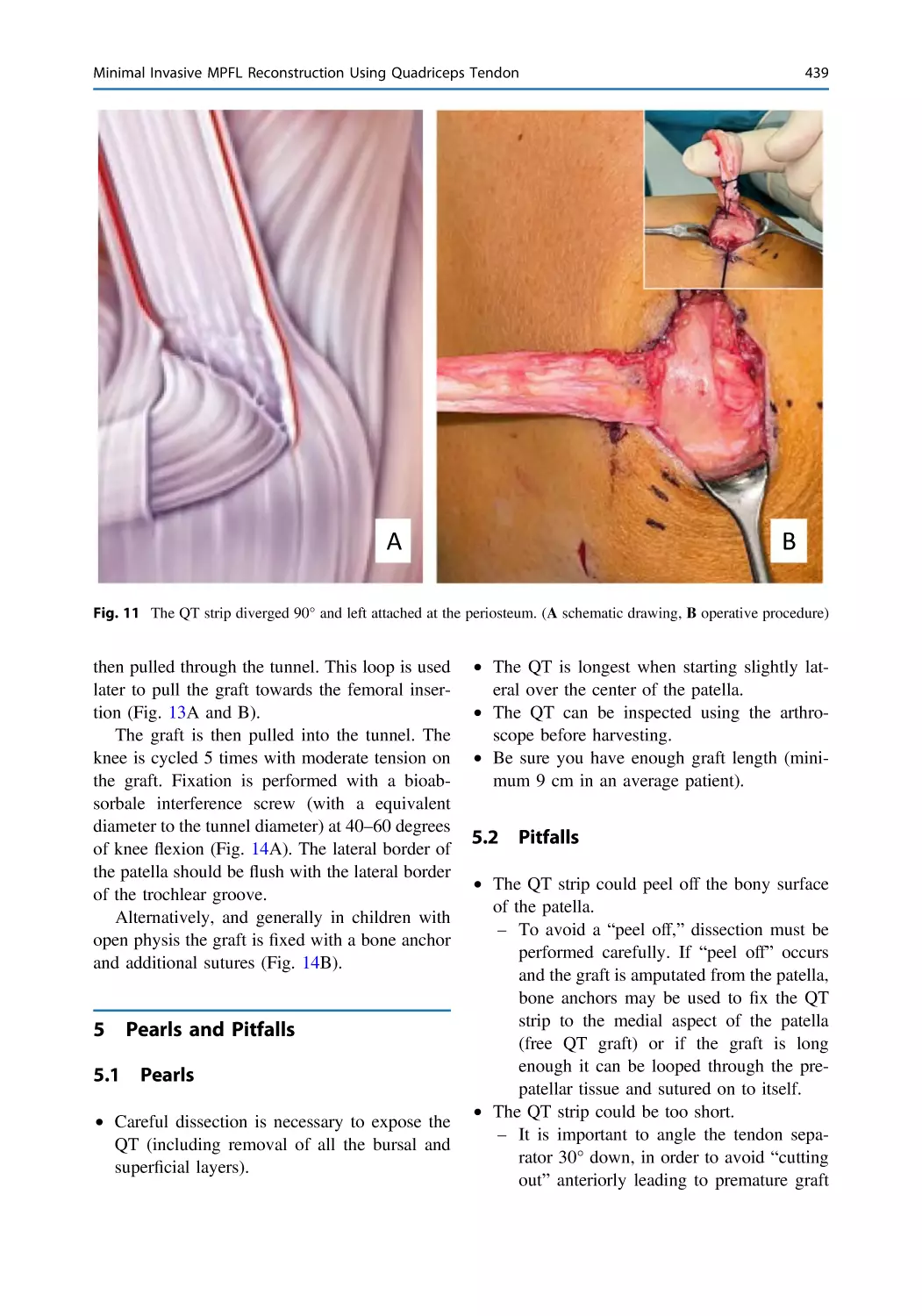 5 Pearls and Pitfalls
5.1 Pearls
5.2 Pitfalls