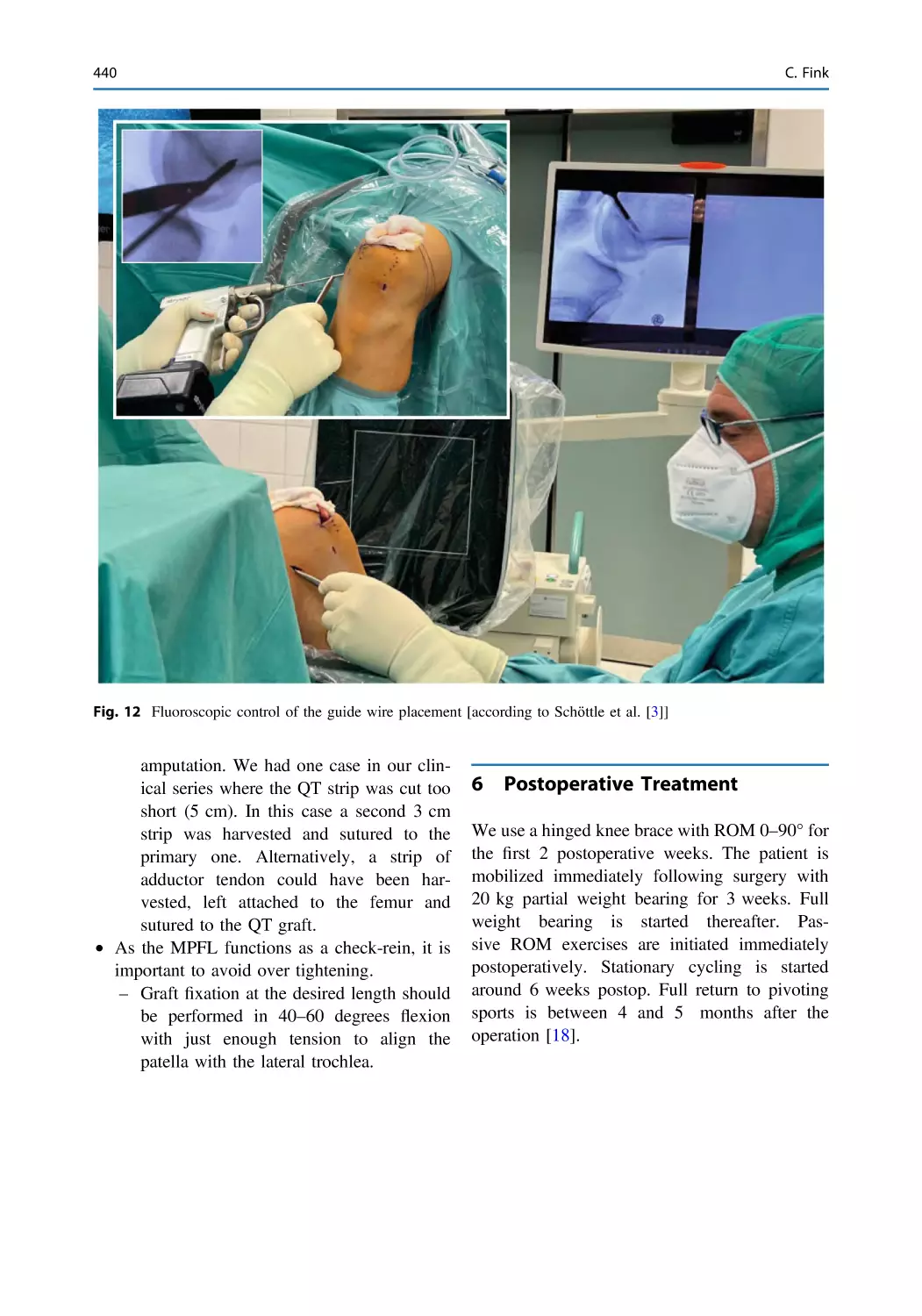 6 Postoperative Treatment