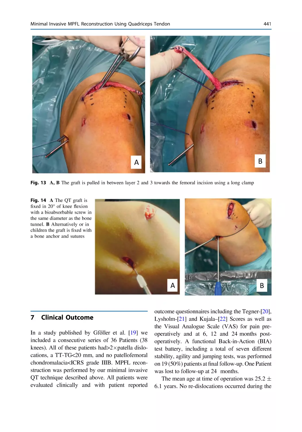 7 Clinical Outcome