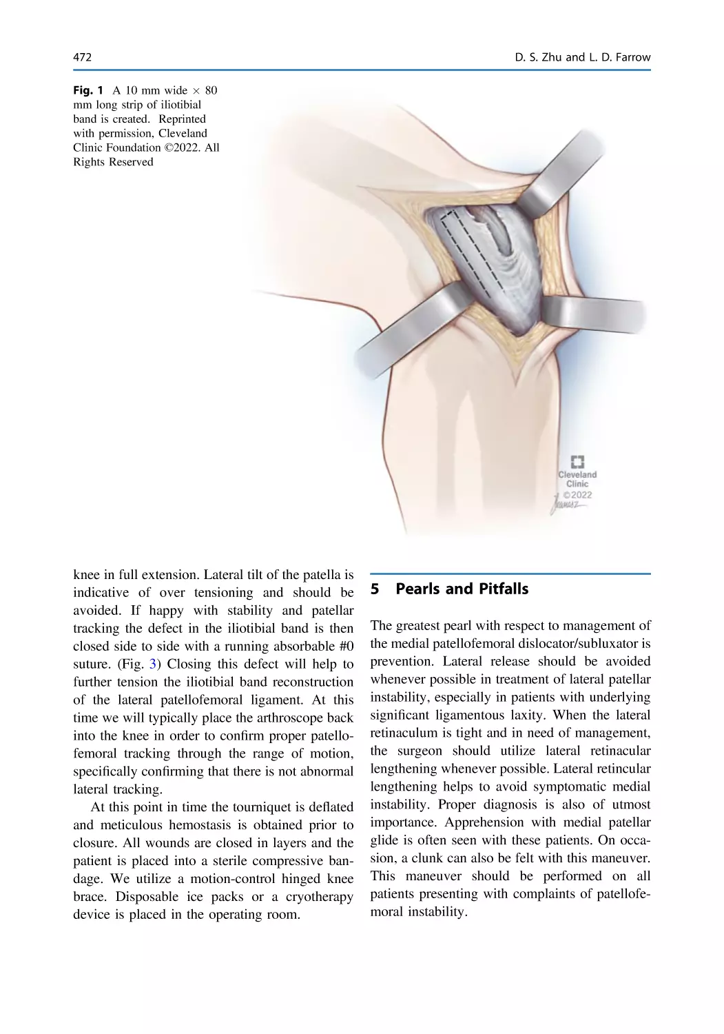 5 Pearls and Pitfalls