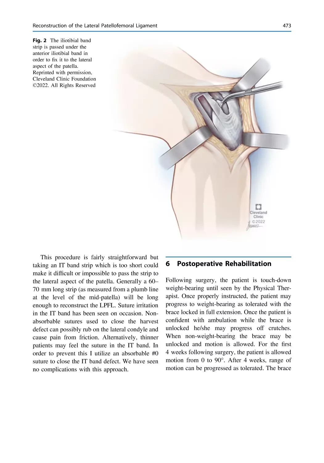 6 Postoperative Rehabilitation