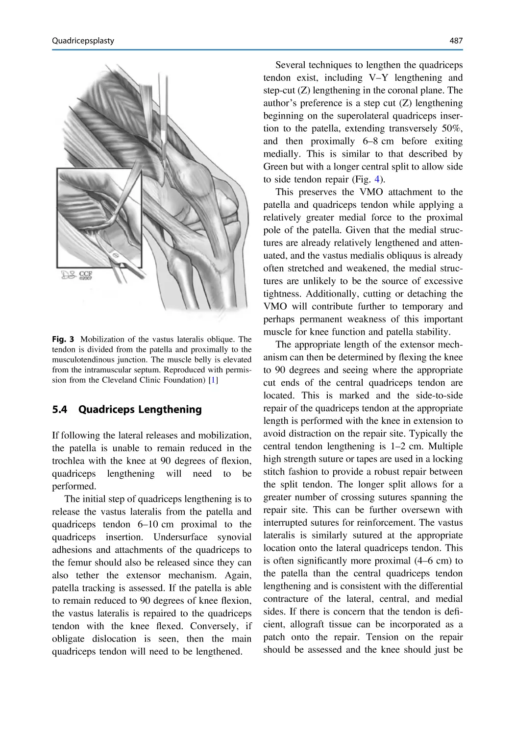 5.4 Quadriceps Lengthening