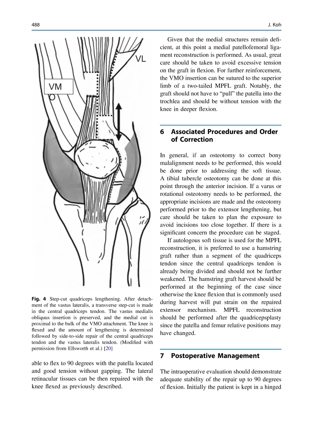 6 Associated Procedures and Order of Correction
7 Postoperative Management