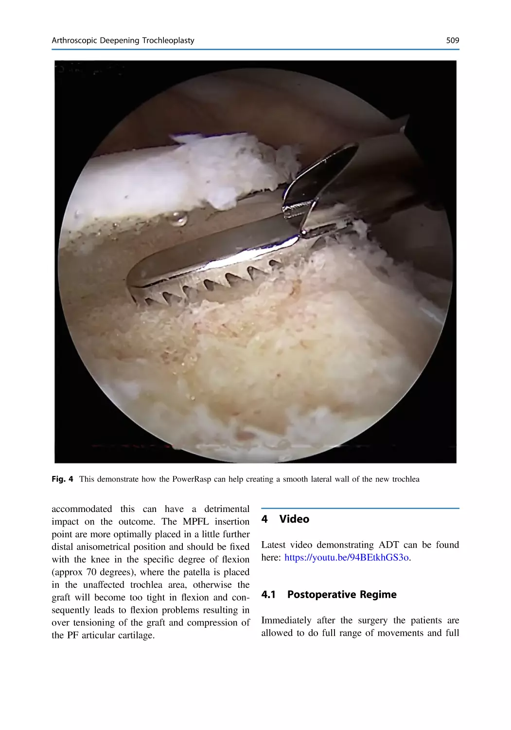 4 Video
4.1 Postoperative Regime