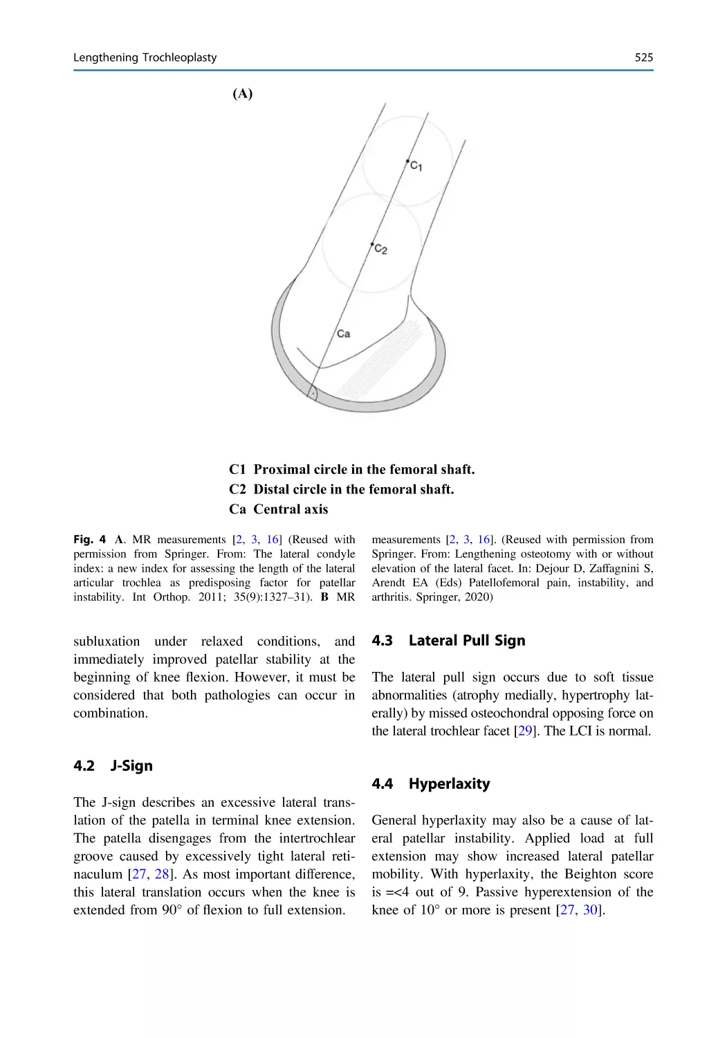 4.2 J-Sign
4.3 Lateral Pull Sign
4.4 Hyperlaxity