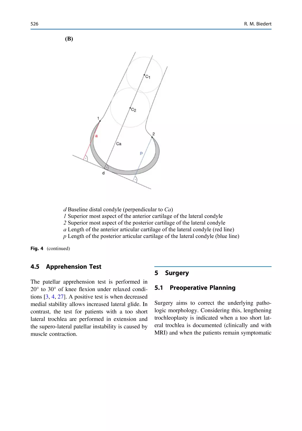 4.5 Apprehension Test
5 Surgery
5.1 Preoperative Planning