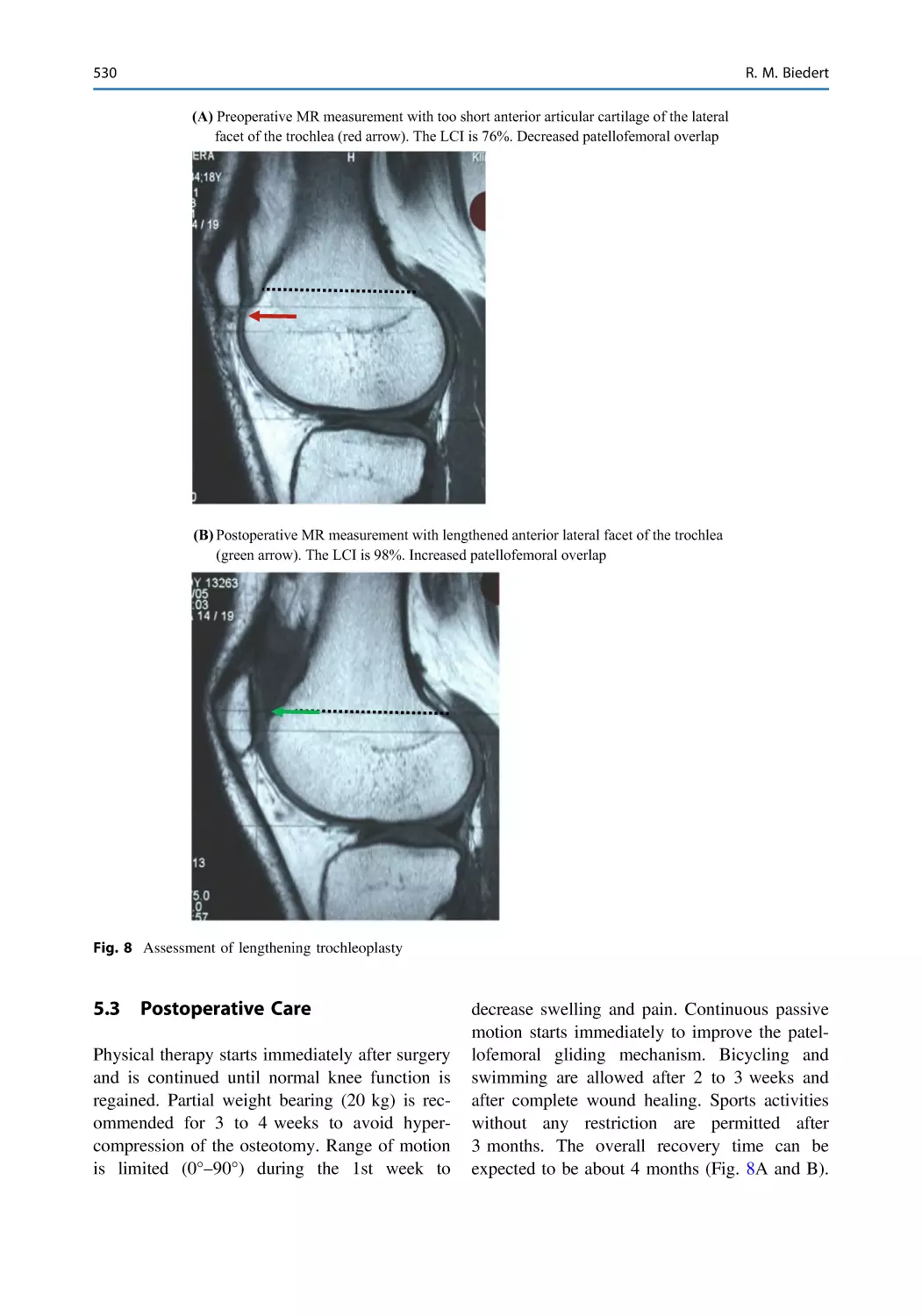 5.3 Postoperative Care