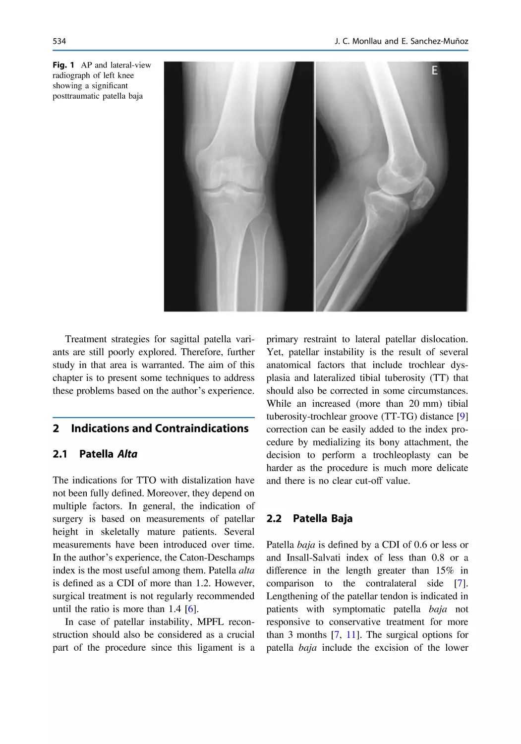 2 Indications and Contraindications
2.1 Patella Alta
2.2 Patella Baja