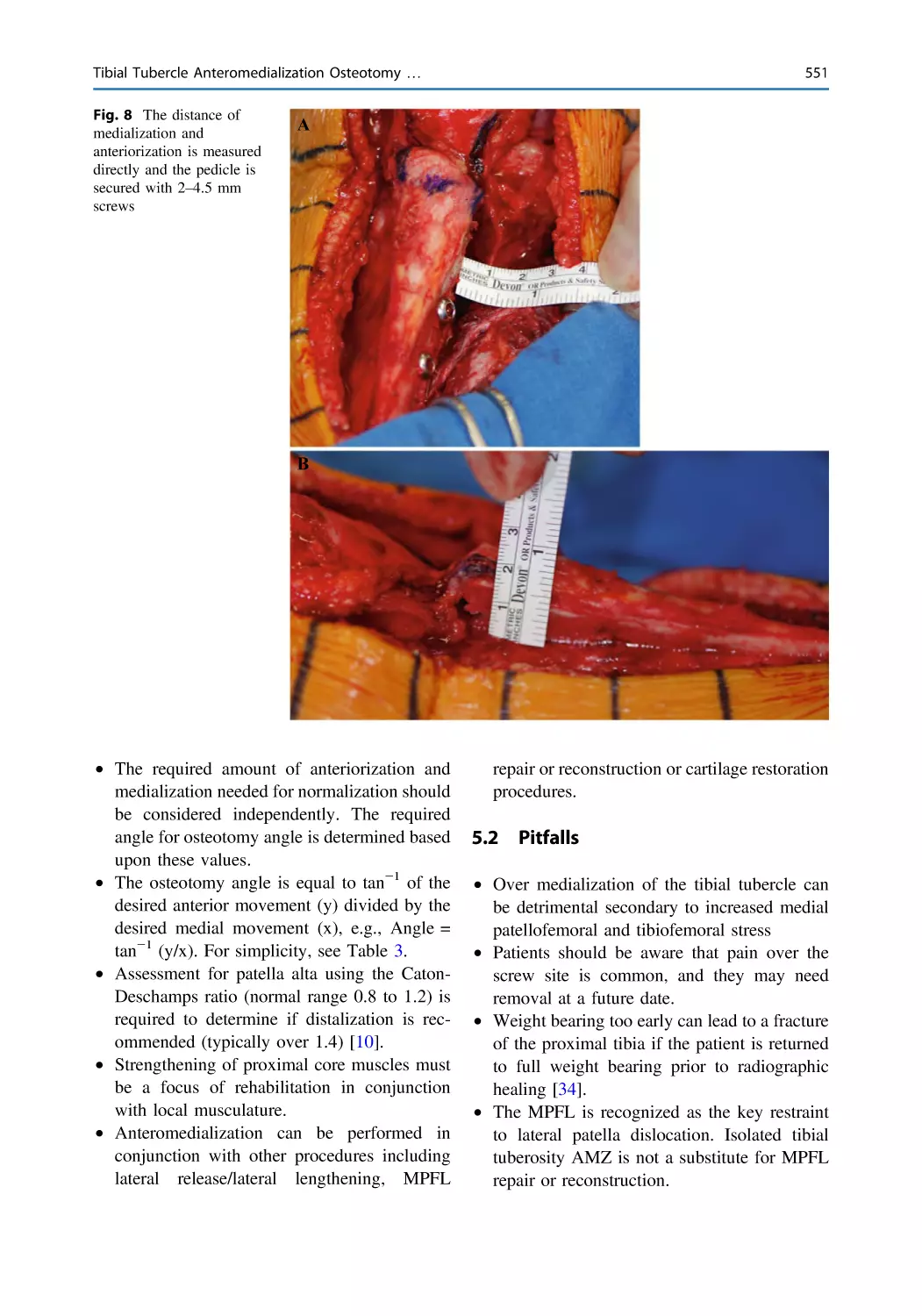 5.2 Pitfalls