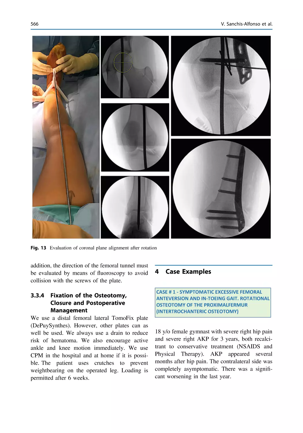 3.3.4 Fixation of the Osteotomy, Closure and Postoperative Management
4 Case Examples