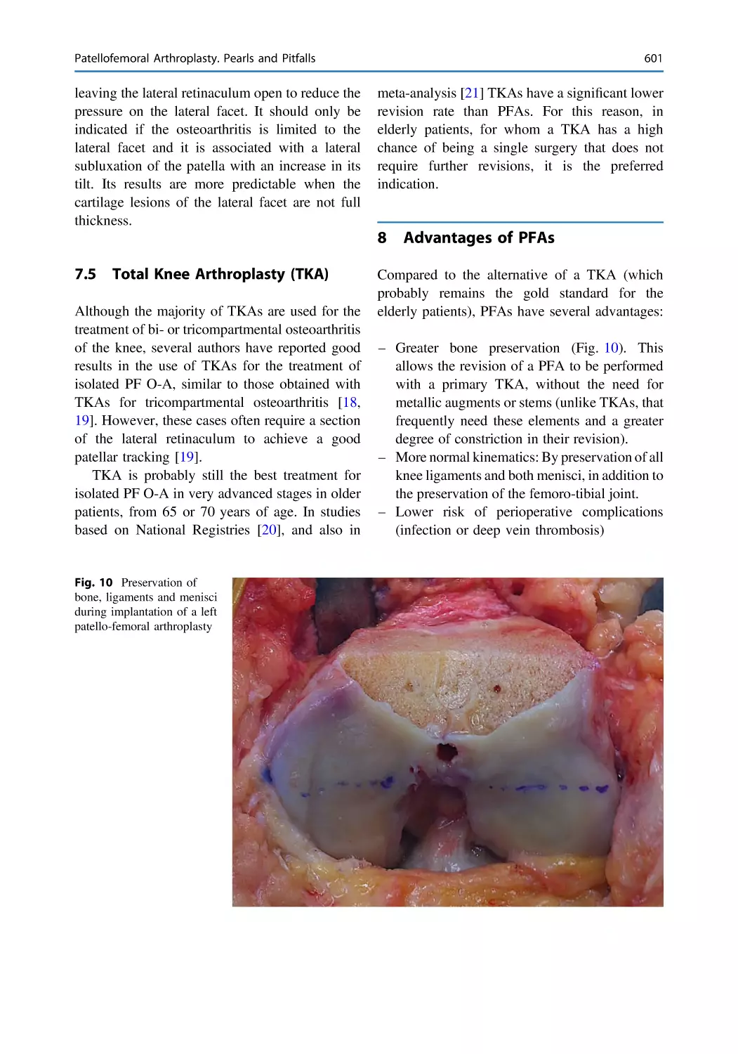 7.5 Total Knee Arthroplasty (TKA)
8 Advantages of PFAs