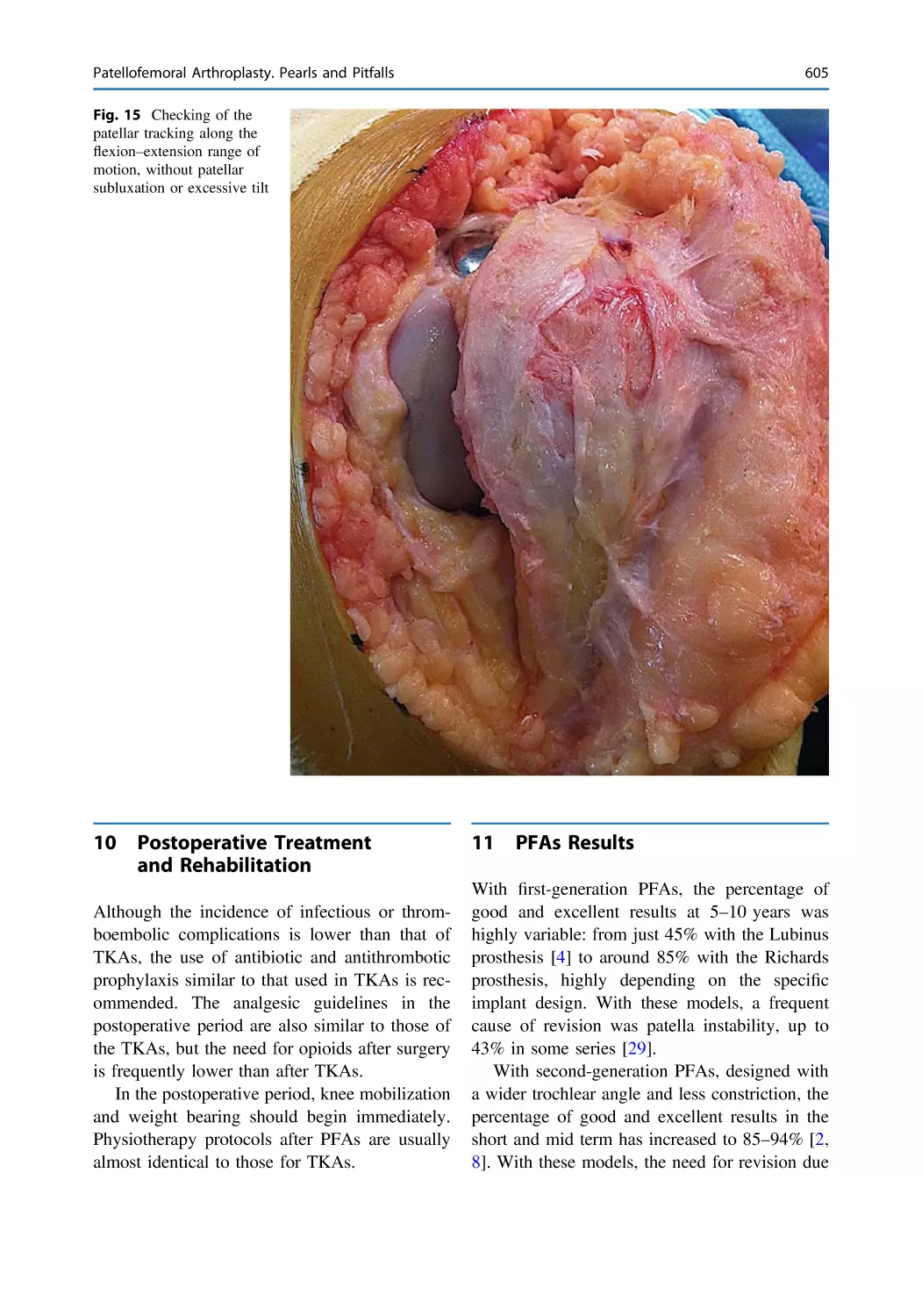 10 Postoperative Treatment and Rehabilitation
11 PFAs Results