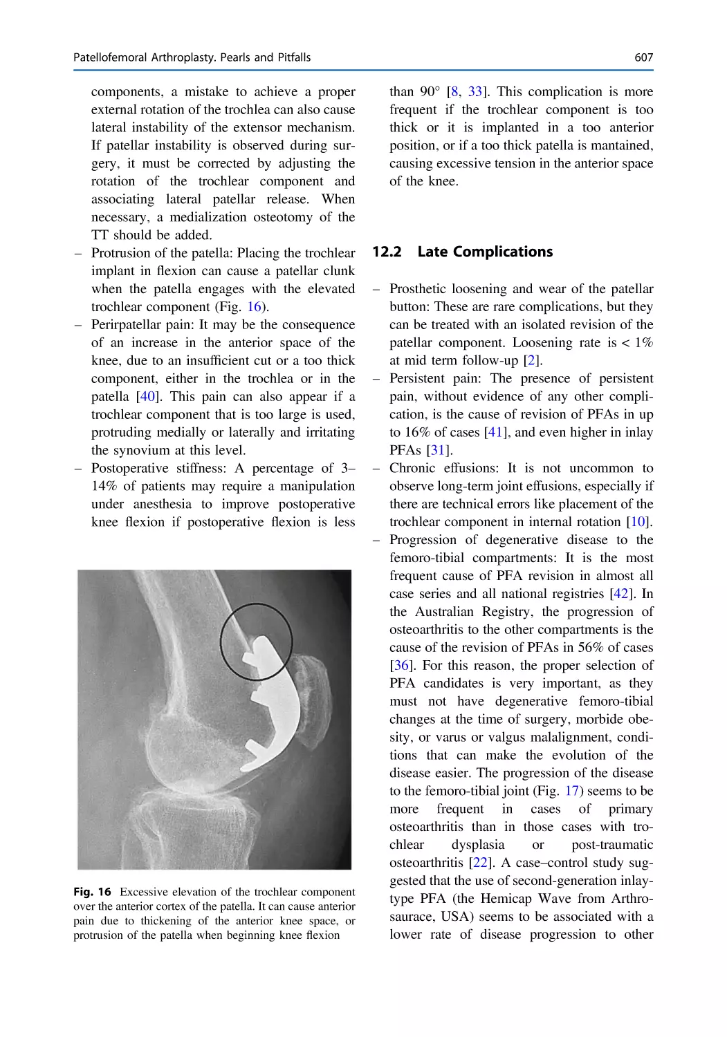 12.2 Late Complications