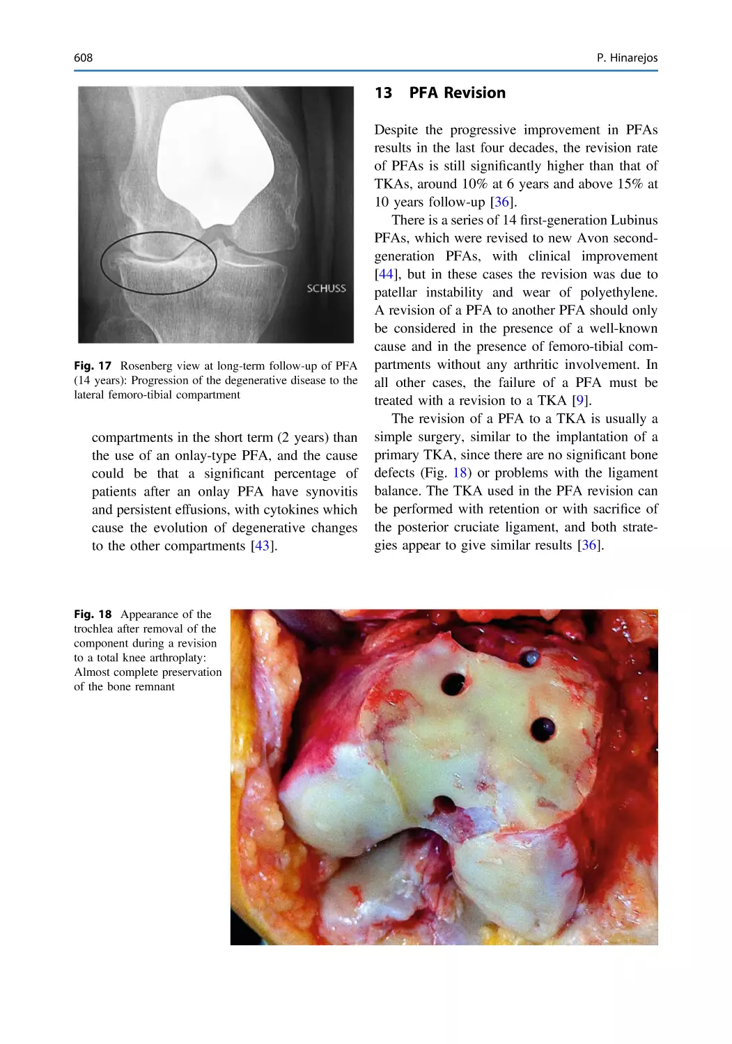 13 PFA Revision