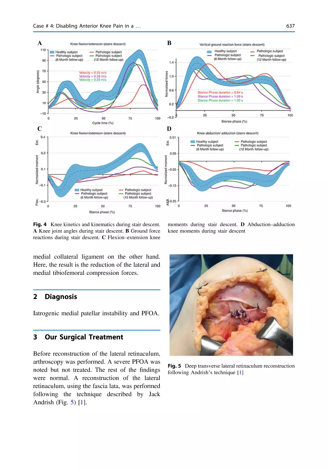 2 Diagnosis
3 Our Surgical Treatment