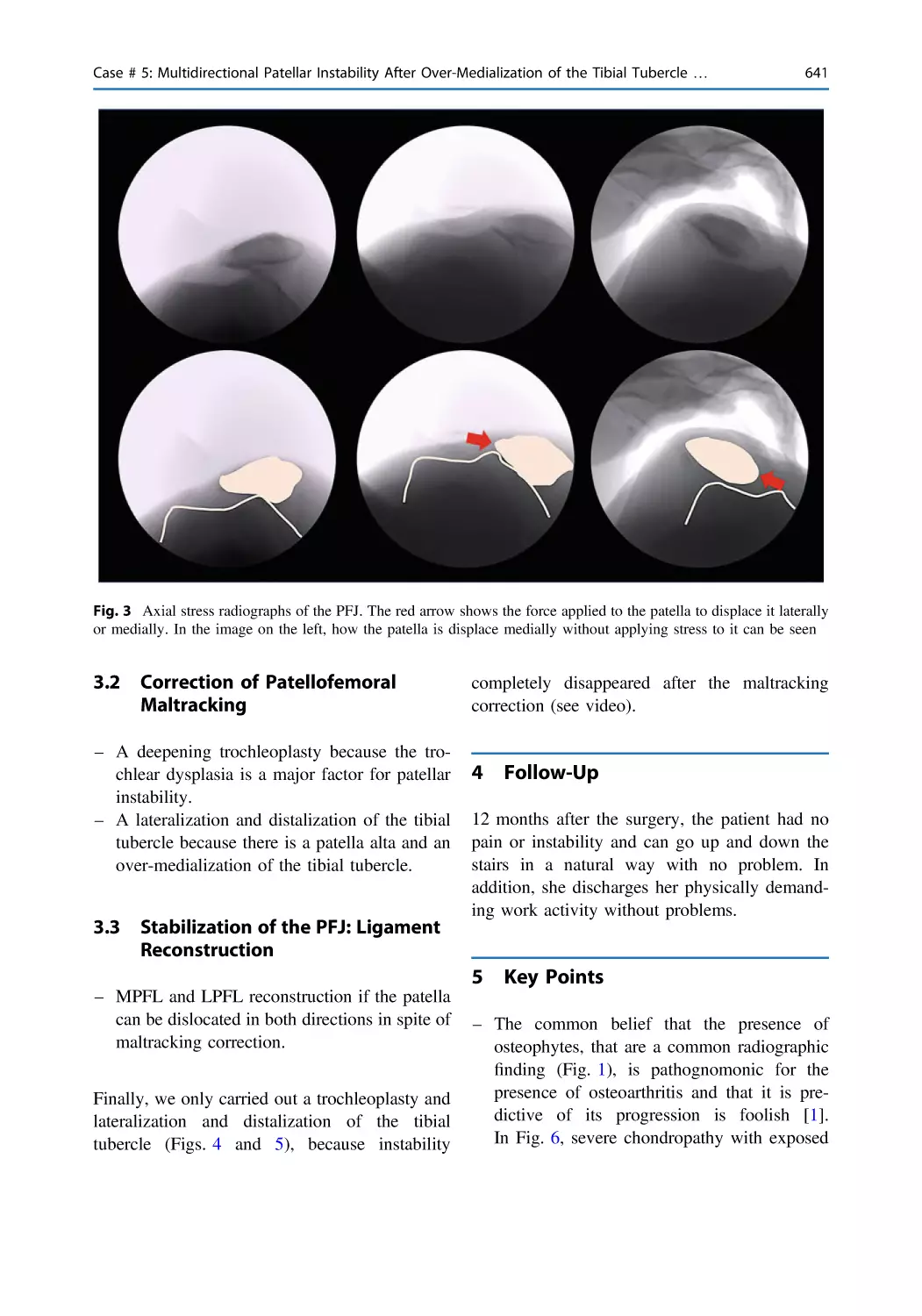 4 Follow-Up
5 Key Points