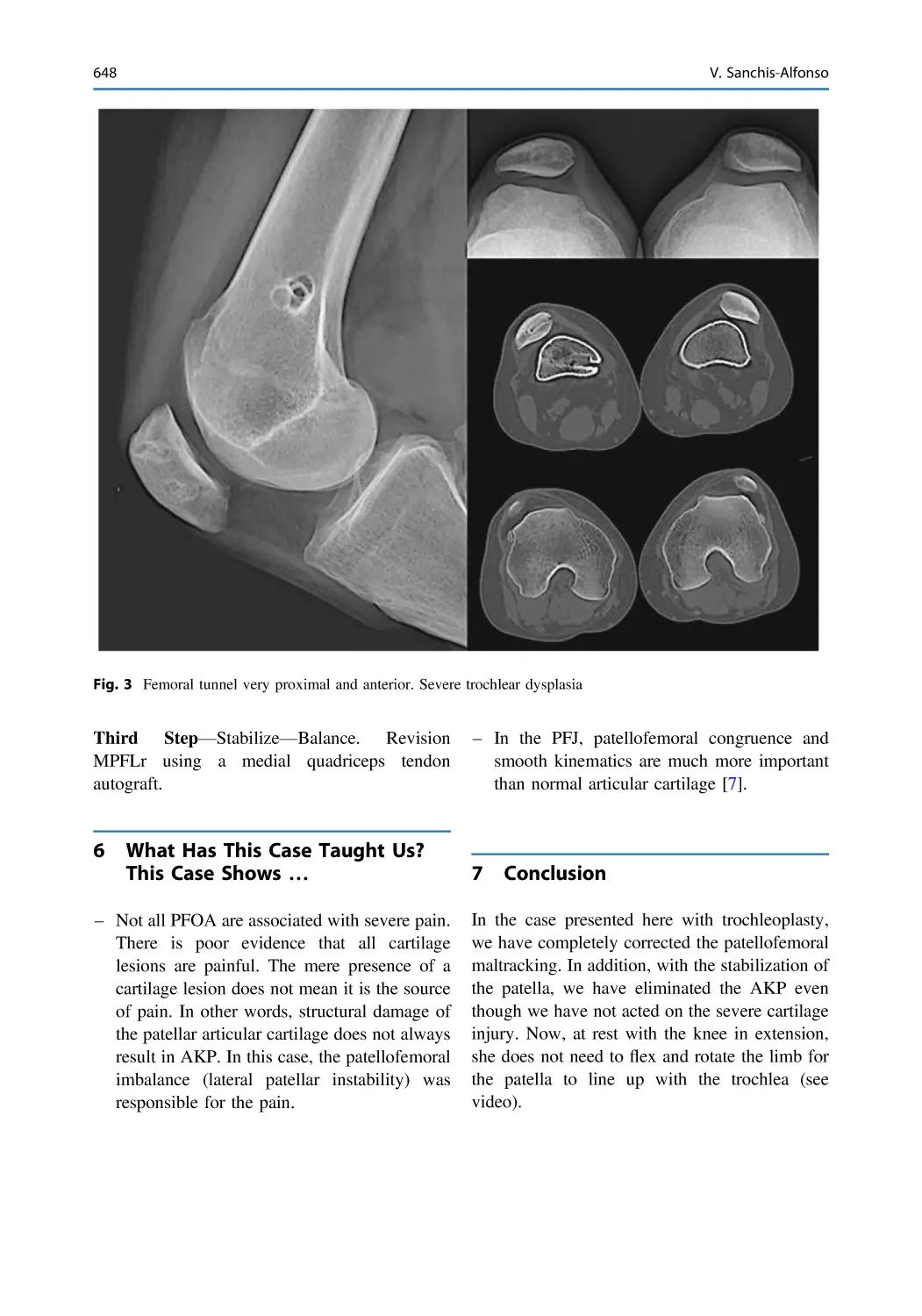 6 What Has This Case Taught Us? This Case Shows …
7 Conclusion