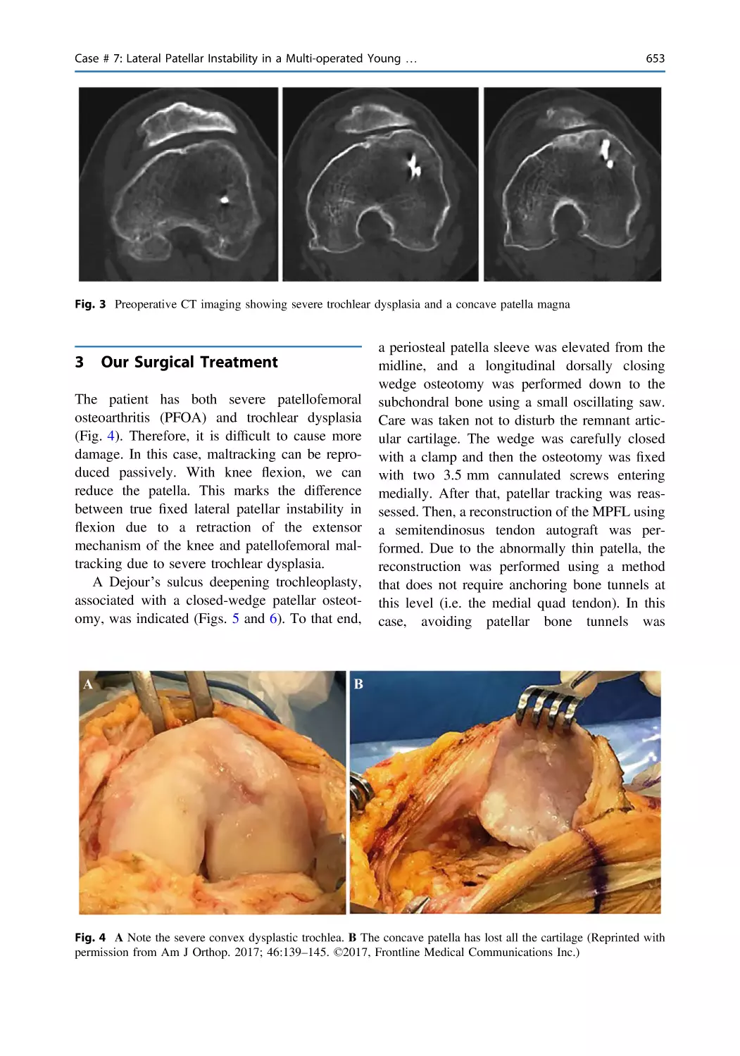 3 Our Surgical Treatment