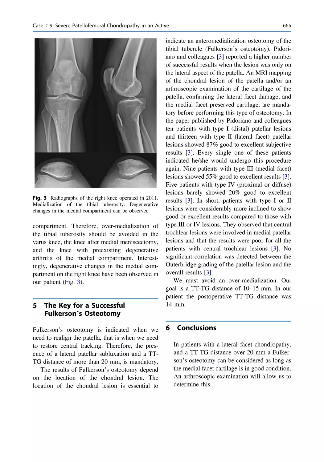 5 The Key for a Successful Fulkerson’s Osteotomy
6 Conclusions