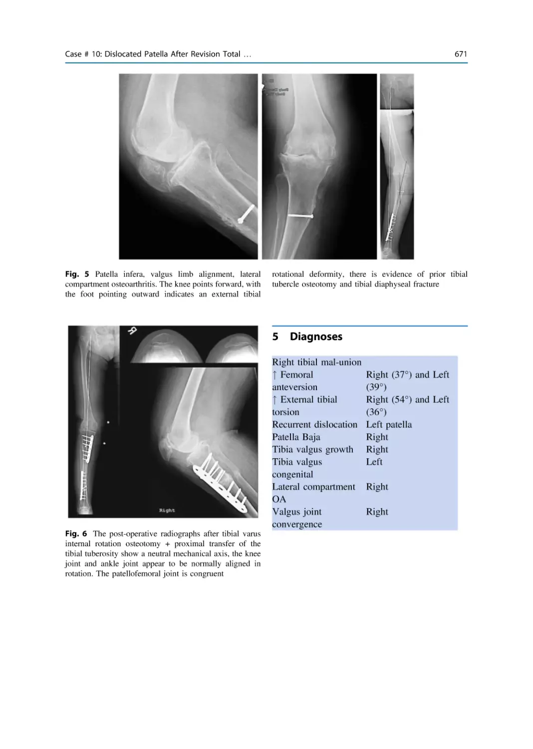 5 Diagnoses