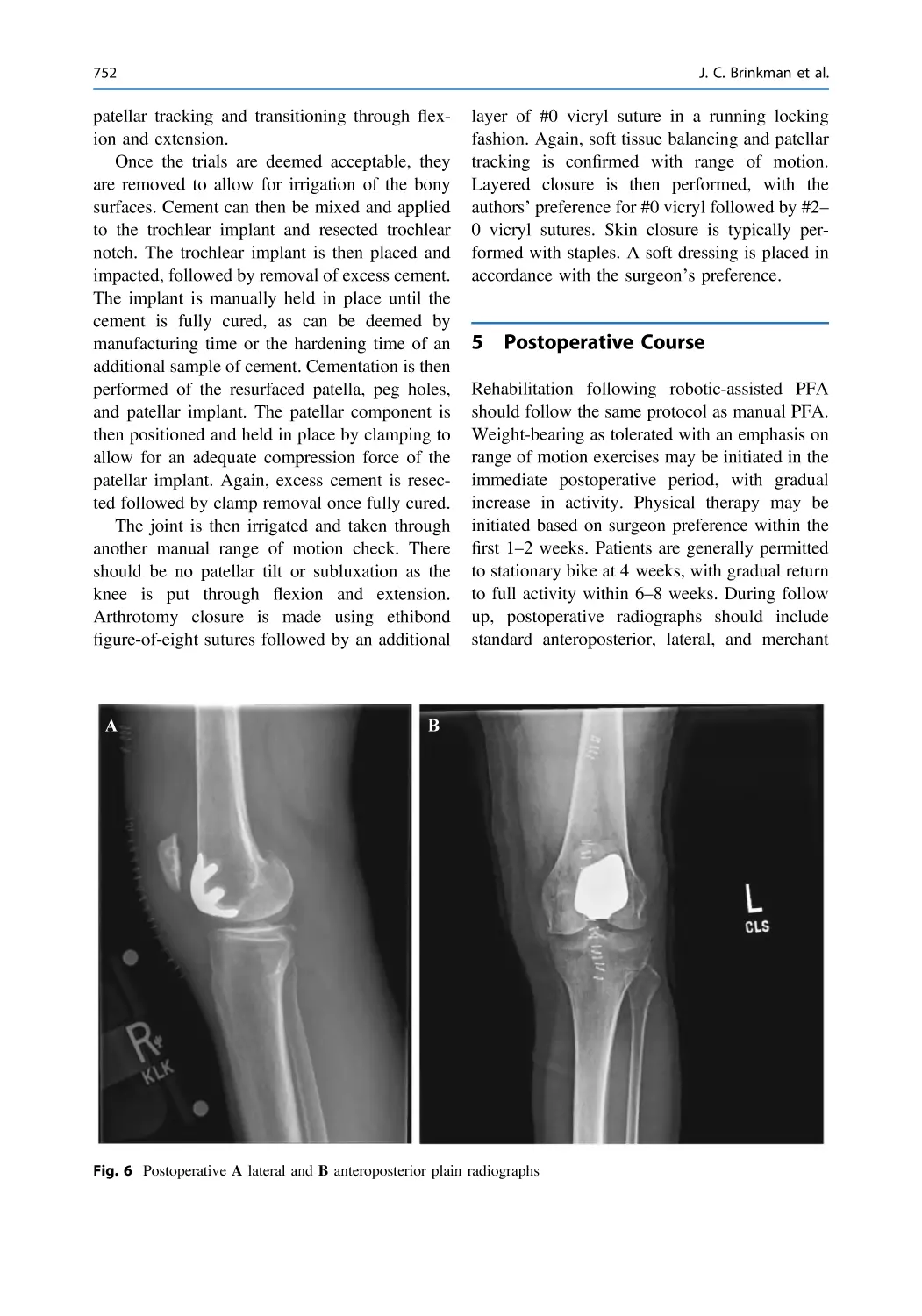 5 Postoperative Course