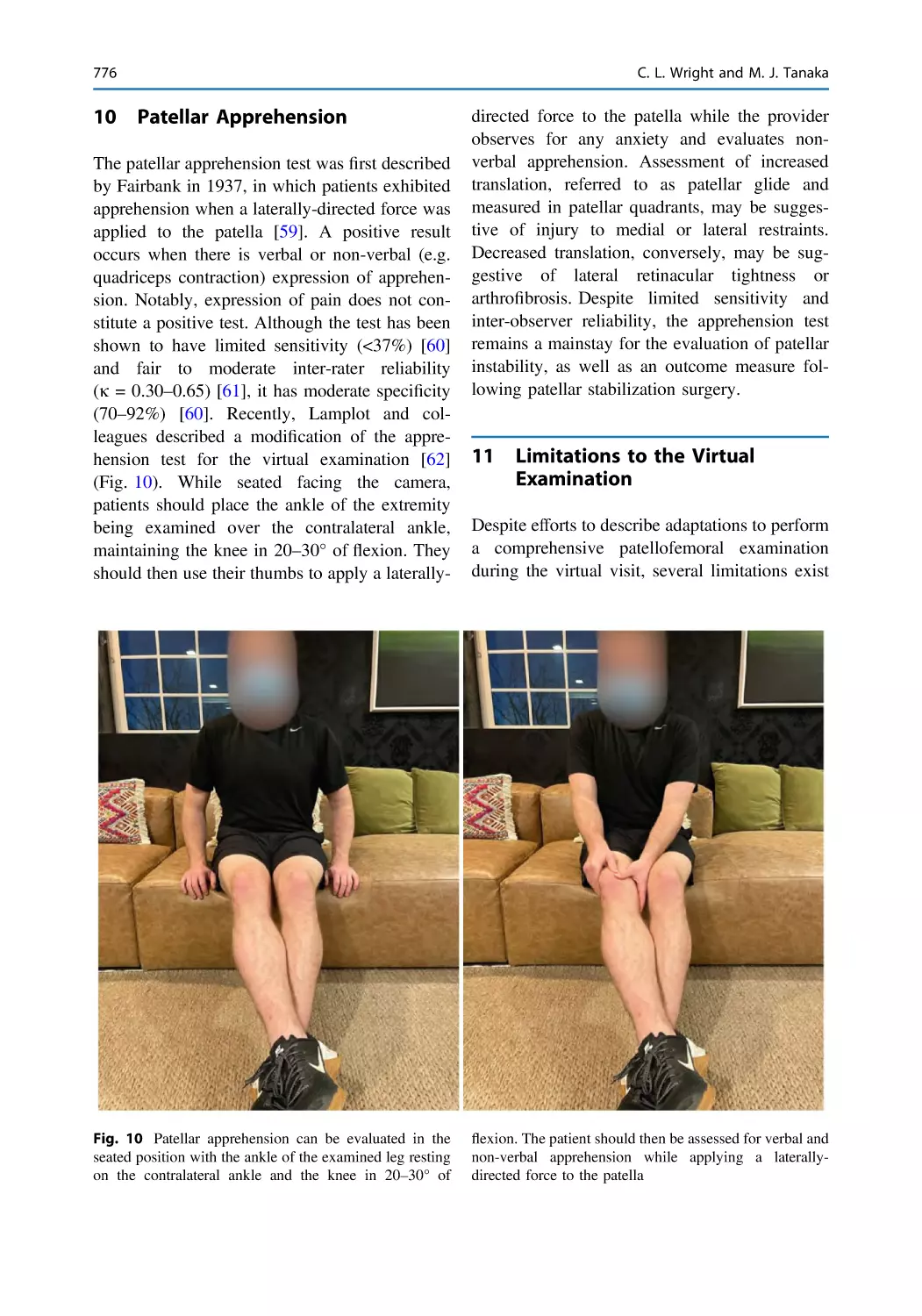 10 Patellar Apprehension
11 Limitations to the Virtual Examination