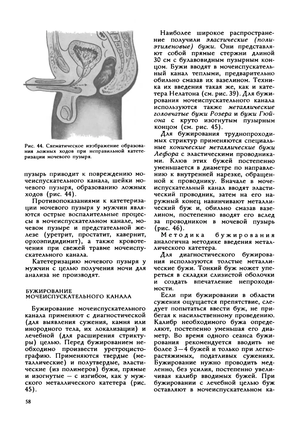 Бужирование мочеиспускательного канала