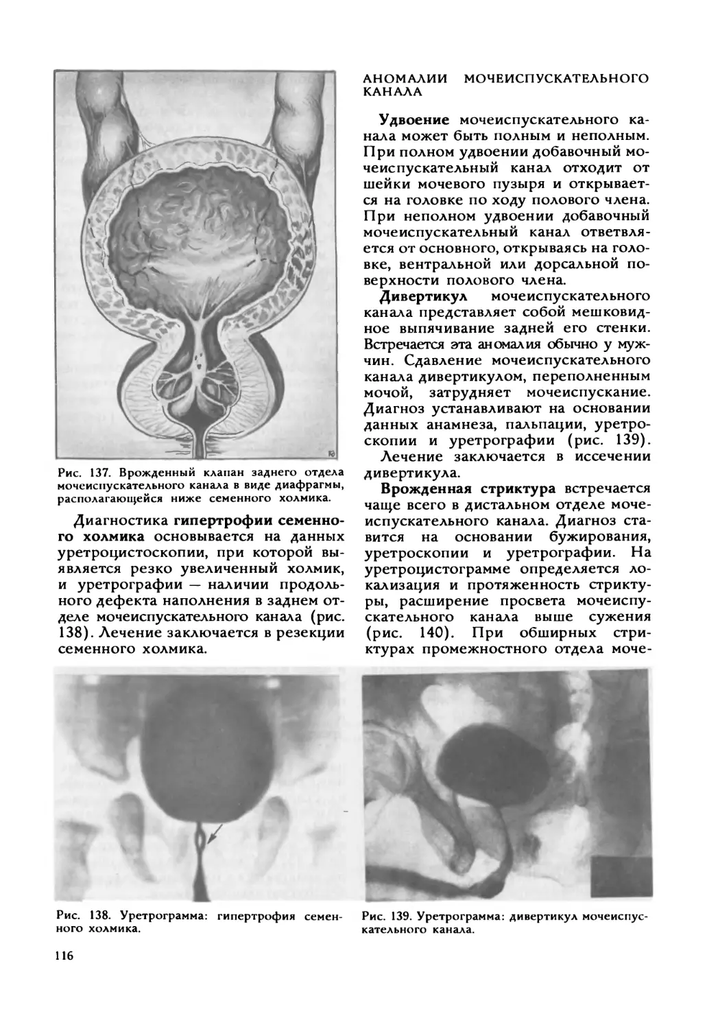 Аномалии мочеиспускательного канала