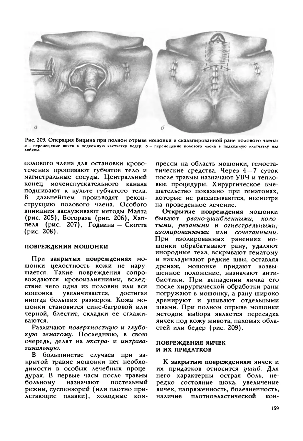 Повреждения мошонки
Повреждения яичек и их придатков