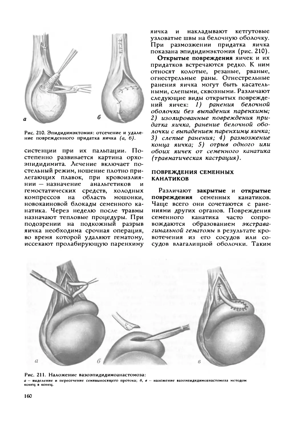 Повреждения семенных канатиков