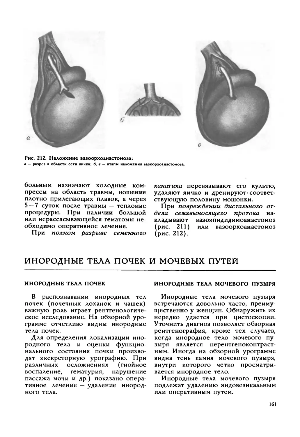 Инородные тела почек и мочевых путей
Инородные тела мочевого пузыря