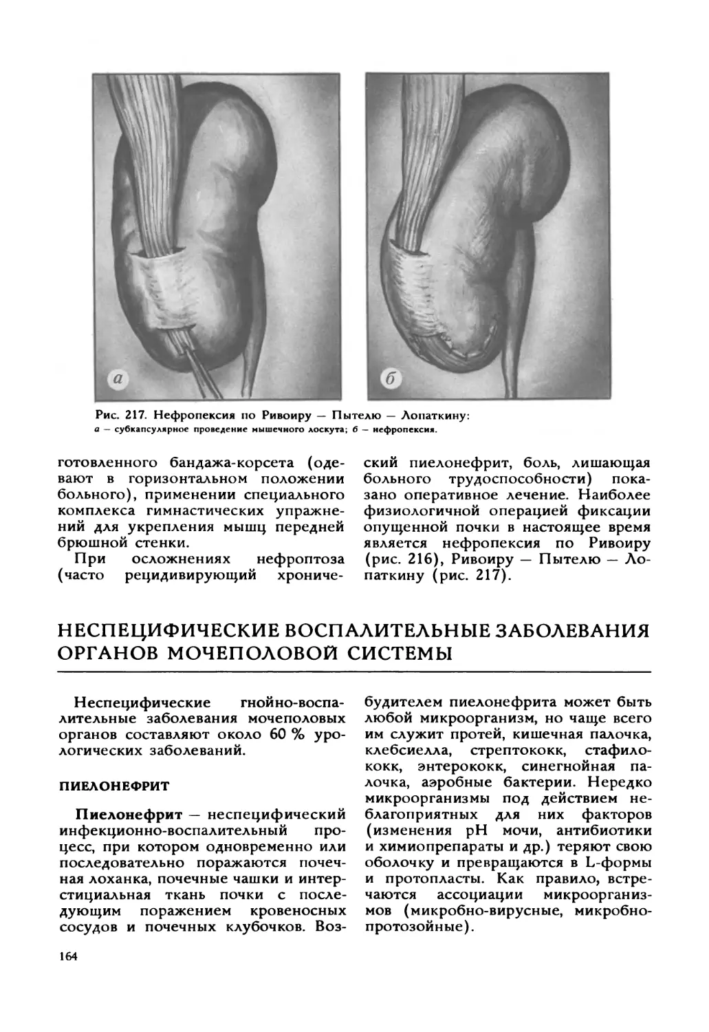 Неспецифические воспалительные заболевания органов мочеполовой системы