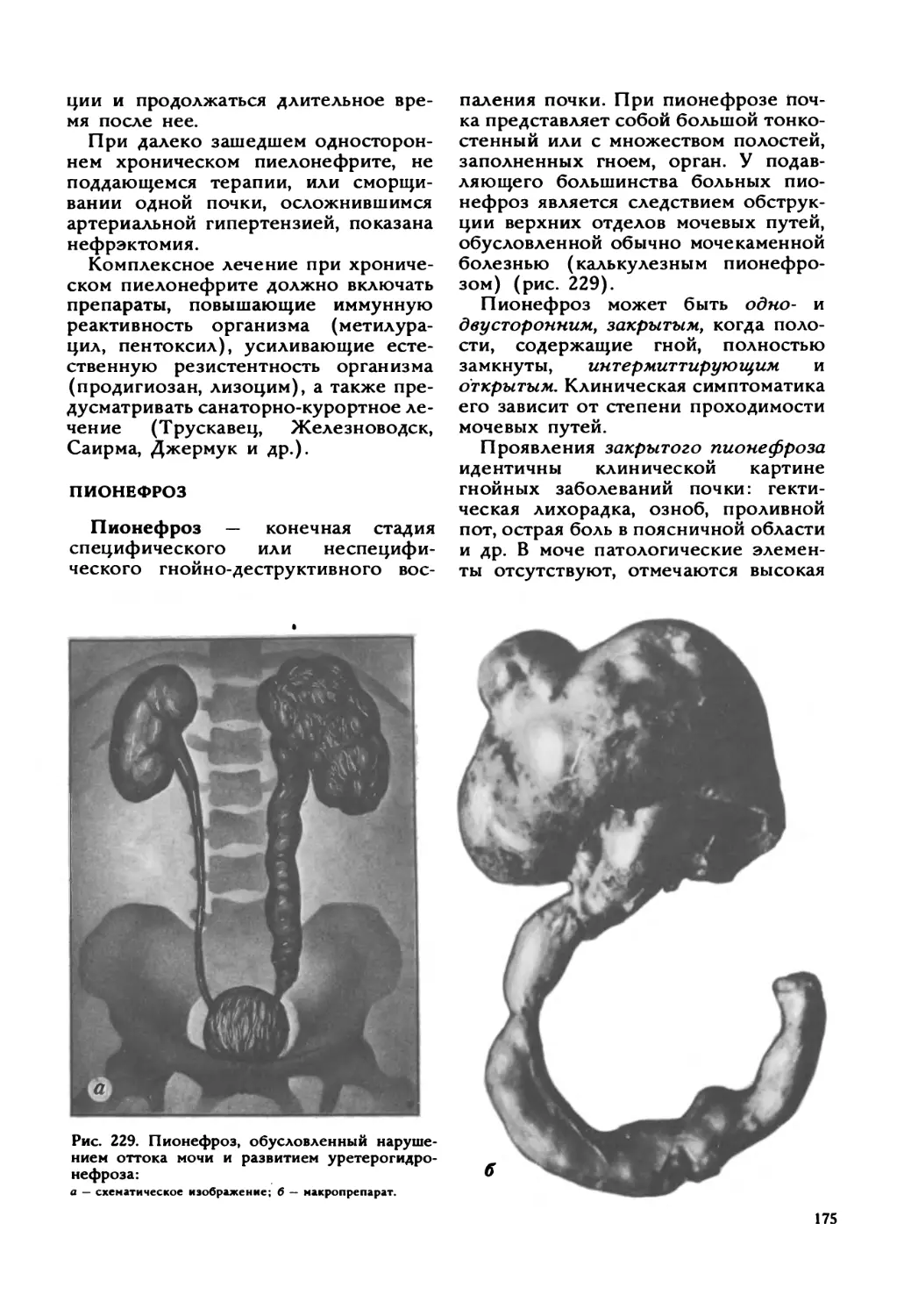 Пионефроз