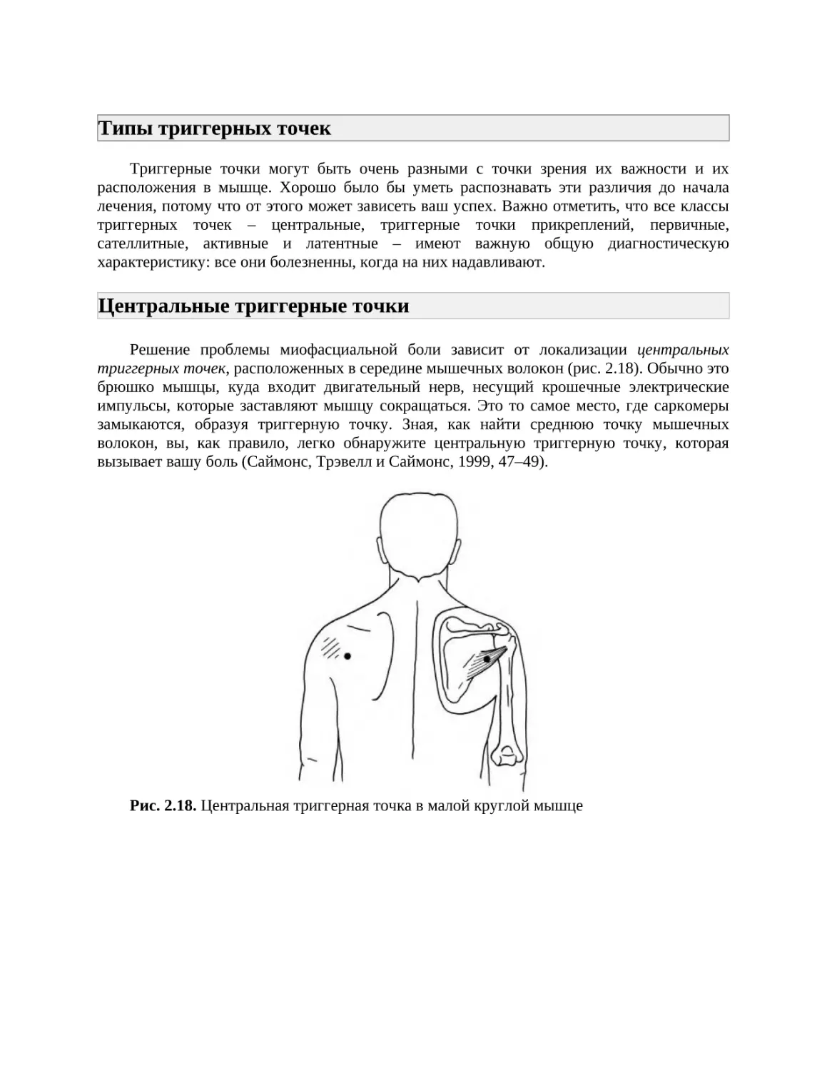 Типы триггерных точек
Центральные триггерные точки