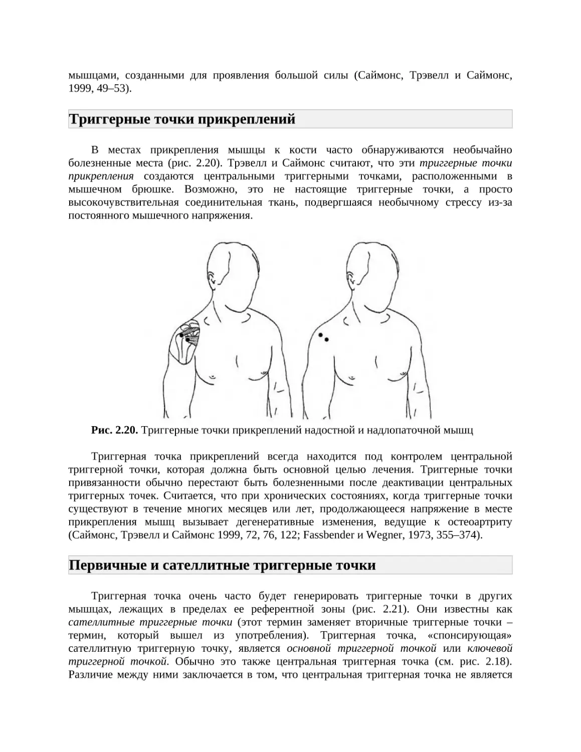 Триггерные точки прикреплений
Первичные и сателлитные триггерные точки