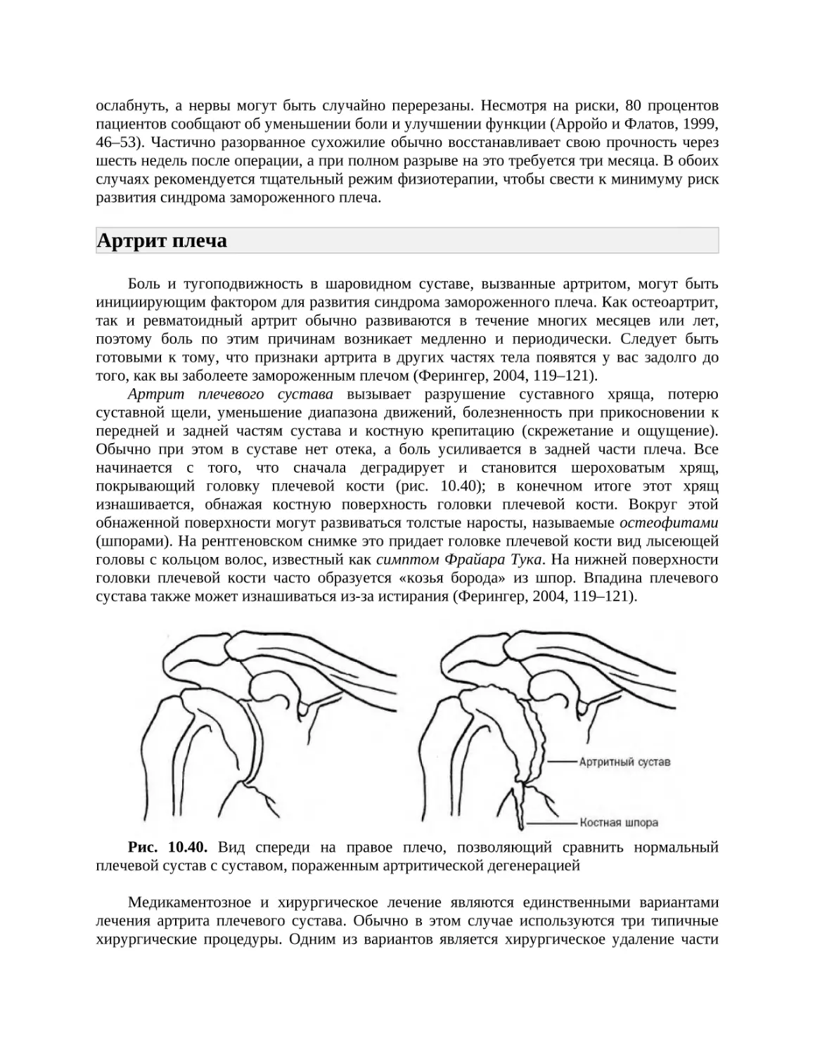 Артрит плеча